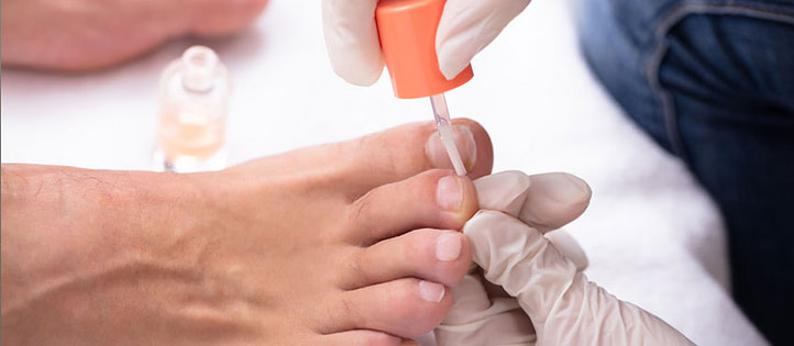 Mittel gegen Nagelpilz Nagellack