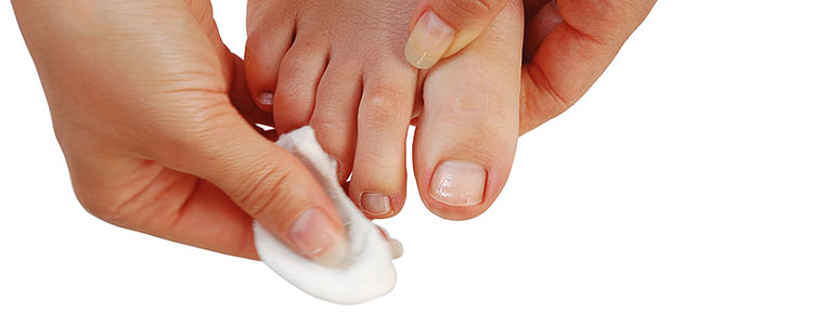 Nagelpilz Teebaumöl anwenden